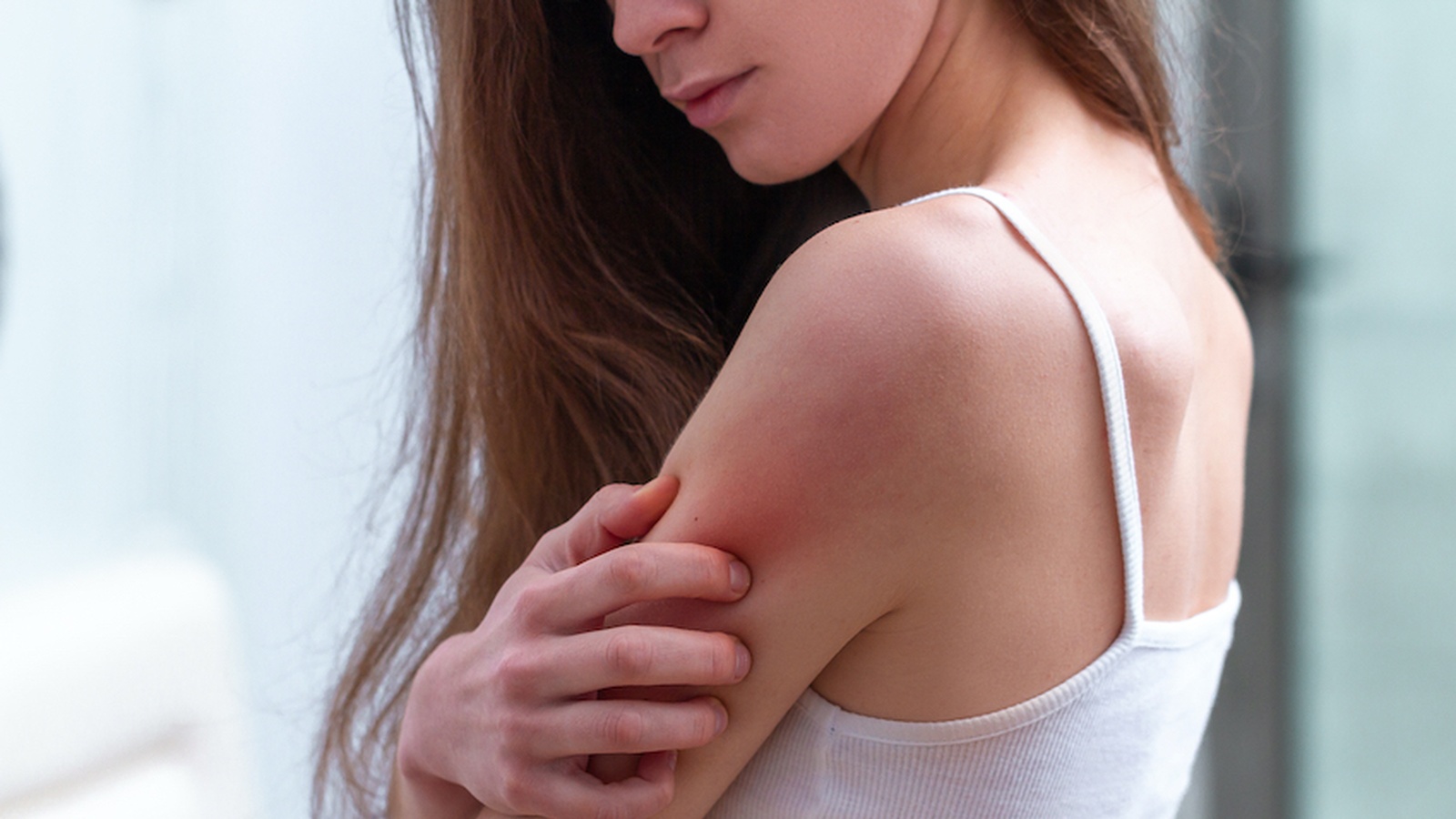 6 Ways To Treat Psoriasis Naturally