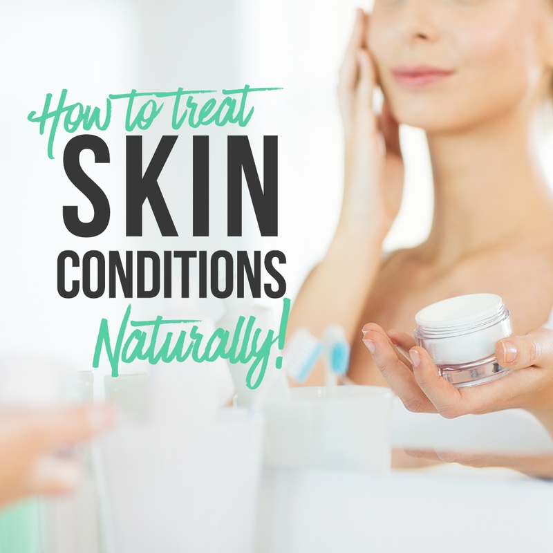How To Treat Skin Conditions Naturally