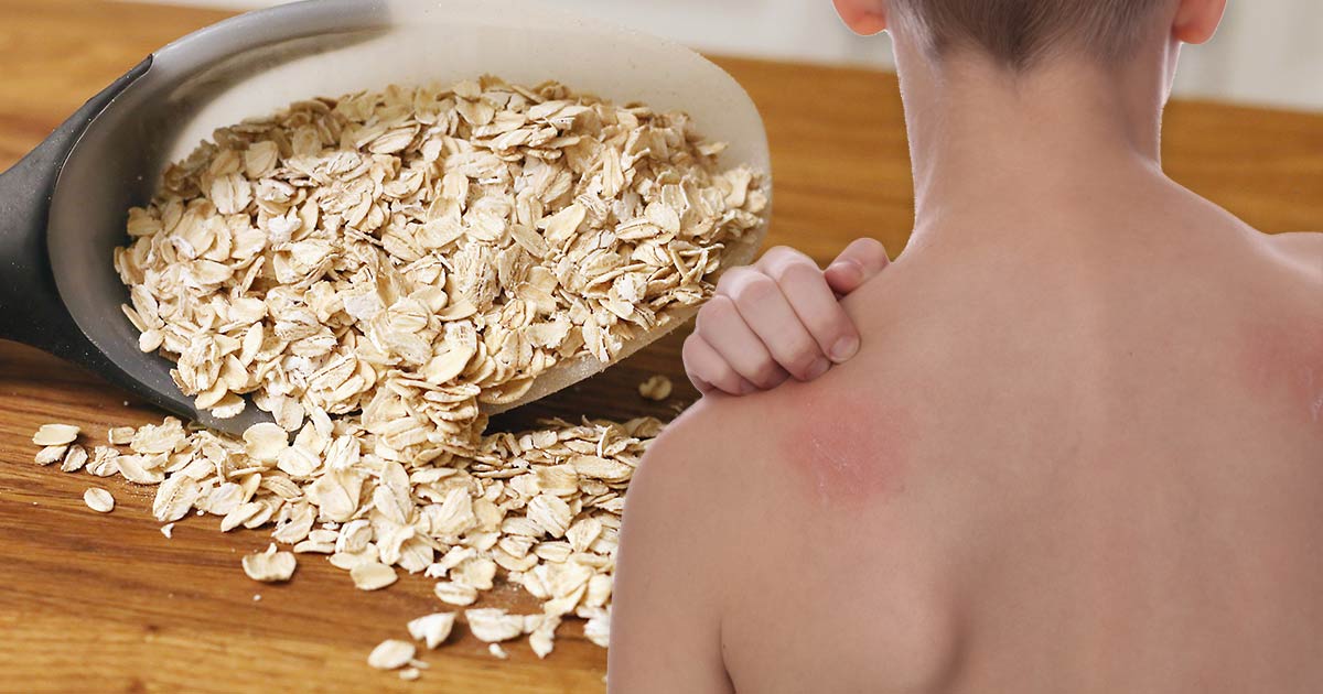 Natural Ways To Relieve Itchy Skin Natural Ways To Relieve Itchy Skin