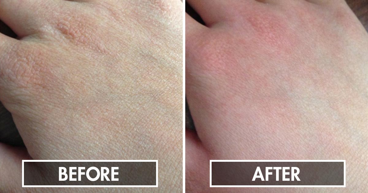 The Benefits Of Using Oil On Your Skin FOOD MATTERS®